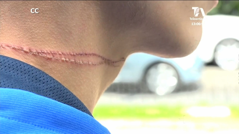 Motociclista denuncia que casi lo matan con un cable instalado en la vía supuestamente para robarlo cable-motociclista