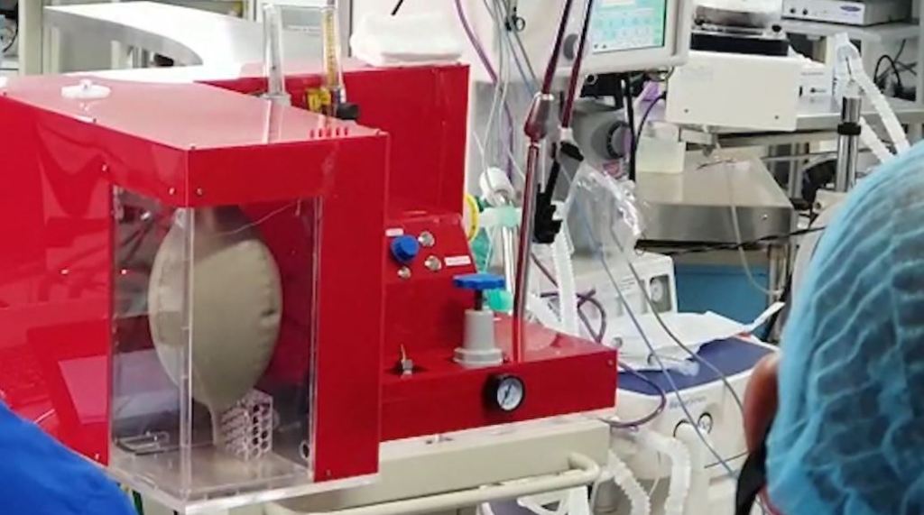 ventiladores_mecánicos