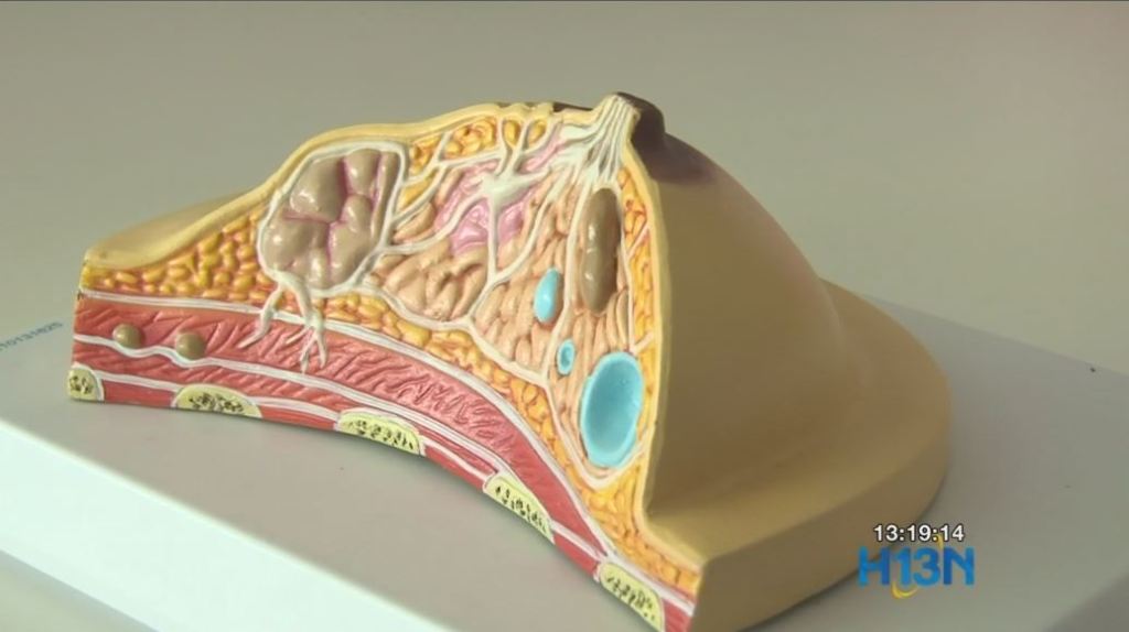 hospital_cáncer_de_mama