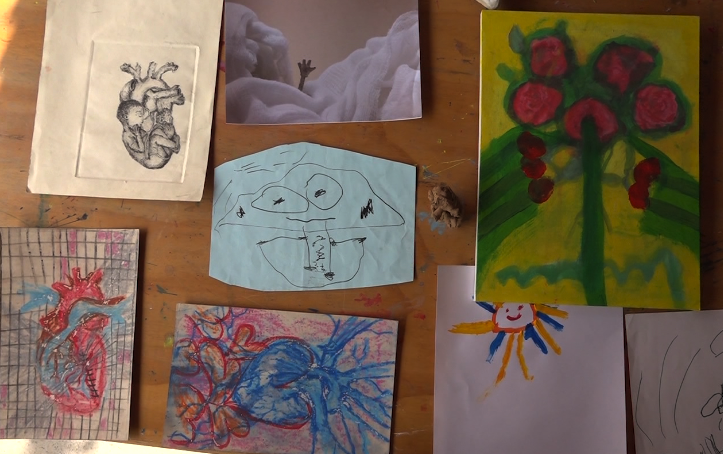 Derec: un niño que con arte espera un trasplante de corazón postre imagen 3