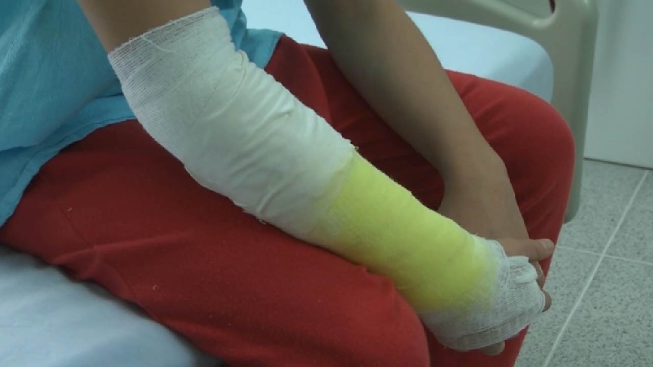 Pólvora: Medellín suma 39 y Antioquia 106 personas quemadas Pólvora