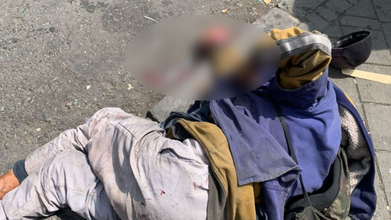 Incidente de tránsito deja un adulto mayor con lesiones graves en una de sus manos adulto mayor