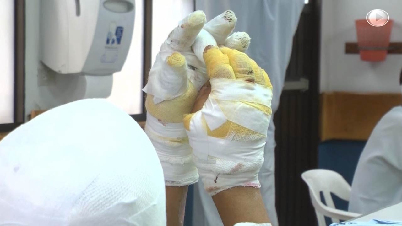 Lesionado polvora