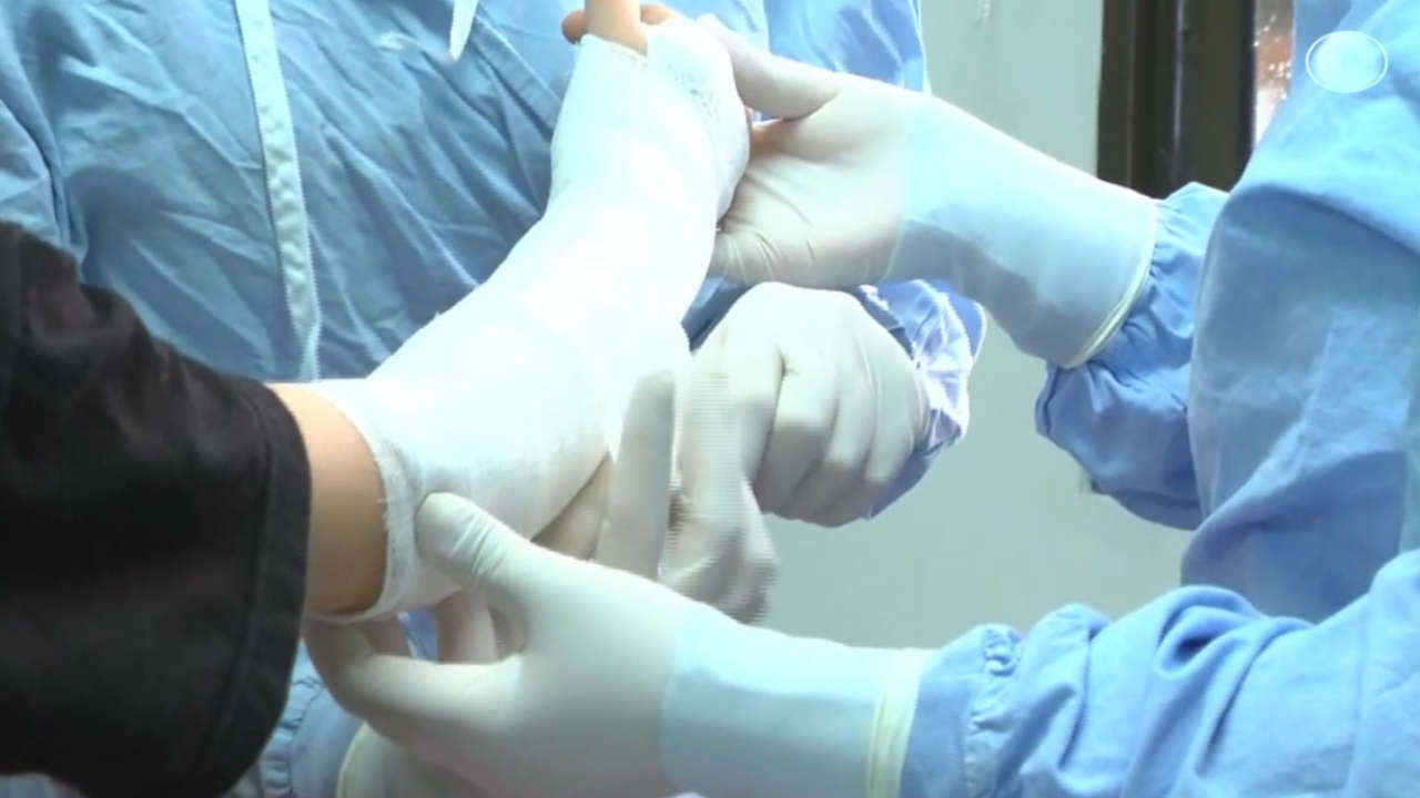 Nuevo caso de quemado con pólvora en Medellín Pólvora