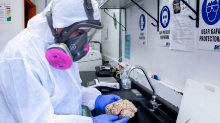 Nueva variante de Alzheimer podría servir para desarrollar su cura