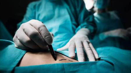 Inspecciones sanitarias dejan 56 medidas de seguridad en establecimientos de estética de Medellín Mujeres fallecen tras procedimientos estéticos en el sur del Valle de Aburrá
