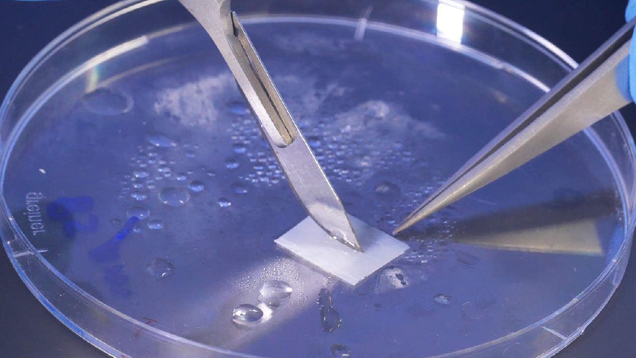 Nueva patente de la UPB: parche cardíaco que funciona como marcapasos