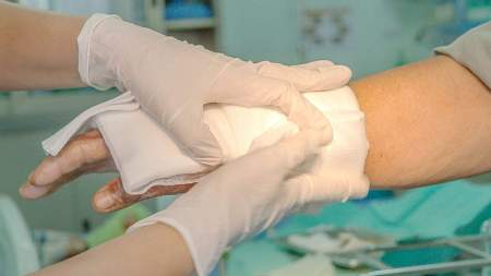 ¿Cómo actuar ante quemaduras por pólvora en diciembre?