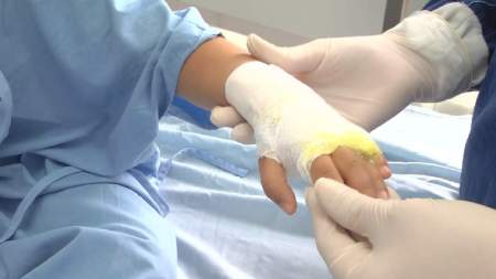 Inicia ampliación de la unidad de quemados del Hospital San Vicente Fundación Antioquia ya ajusta 65 casos de lesionados por pólvora