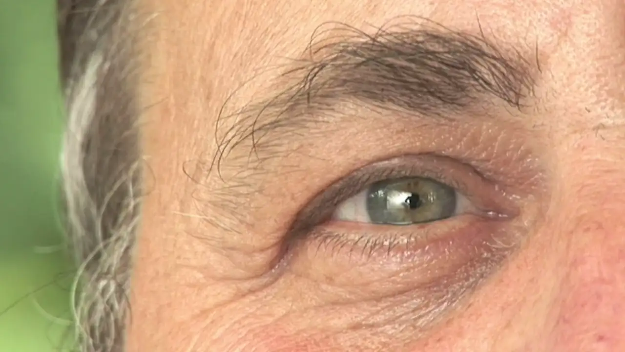 glaucoma-ceguera-poblacion-mundial