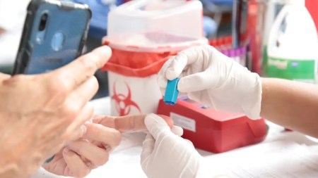 hepatitis a