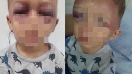 ¡Indignante-En-Itagui-un-pequenito-de-3-anos-fue-golpeado-salvajemente-por-un-hombre