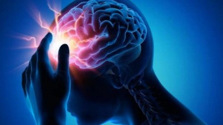 cerebro - accidente-cerebrovascular-recomendacioones-prevencion