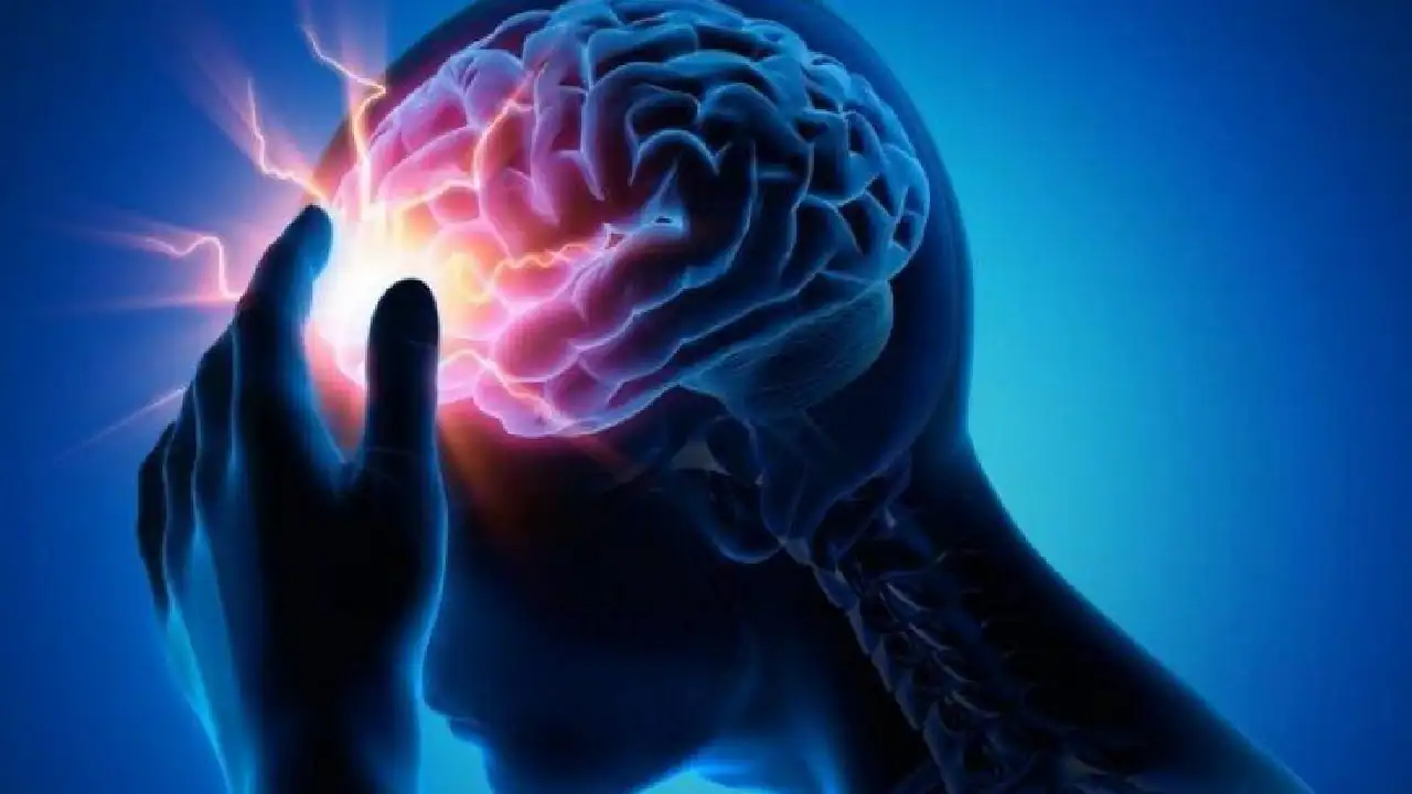 En Colombia fallecen más mujeres por accidentes cerebrovasculares: entidades de salud buscan prevenirlos cerebro - accidente-cerebrovascular-recomendacioones-prevencion