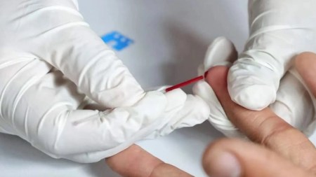 En Antioquia se realizan Jornadas gratuitas de pruebas rápidas de VIH con entrega de resultados inmediatos