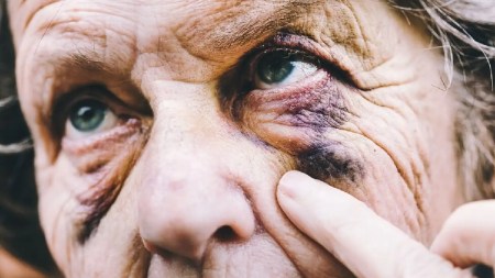 agresion-adulta-mayor-medellin-riña