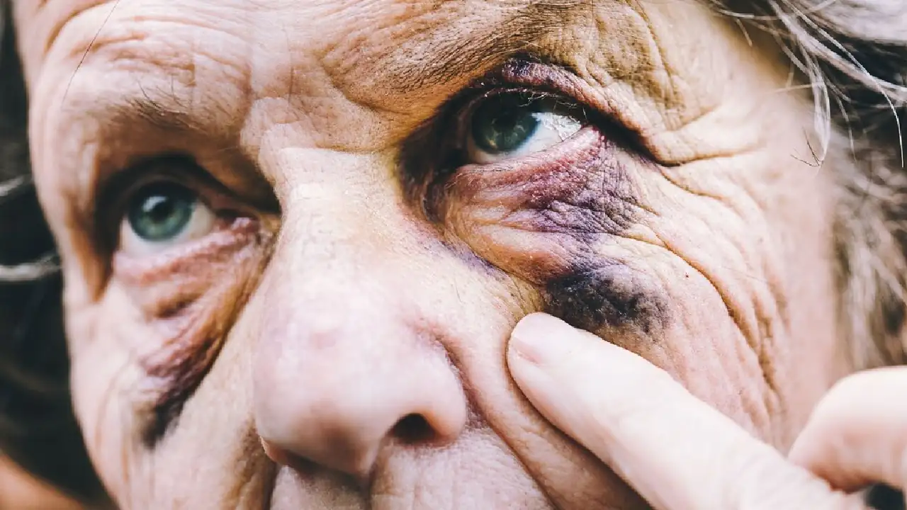 agresion-adulta-mayor-medellin-riña