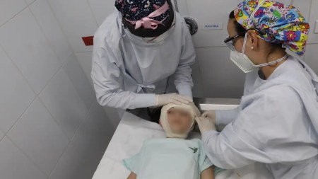 maquina-quemados-cuerpo-campaña-donaciones