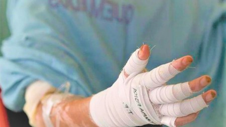 Estos son los nuevos casos de quemados por pólvora en Antioquia