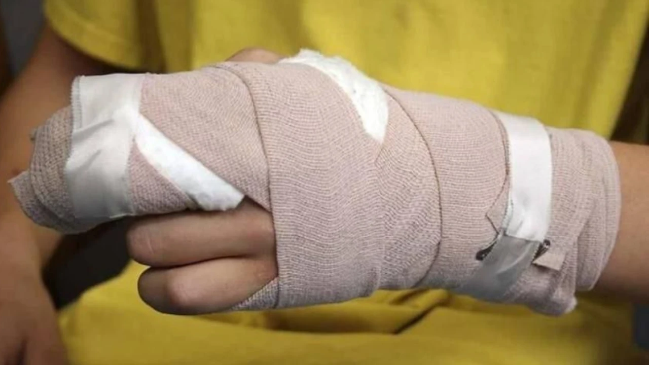 ¡Asciende a 44 los casos de quemados por pólvora en Antioquia! 22 lesionados por pólvora en Medellín