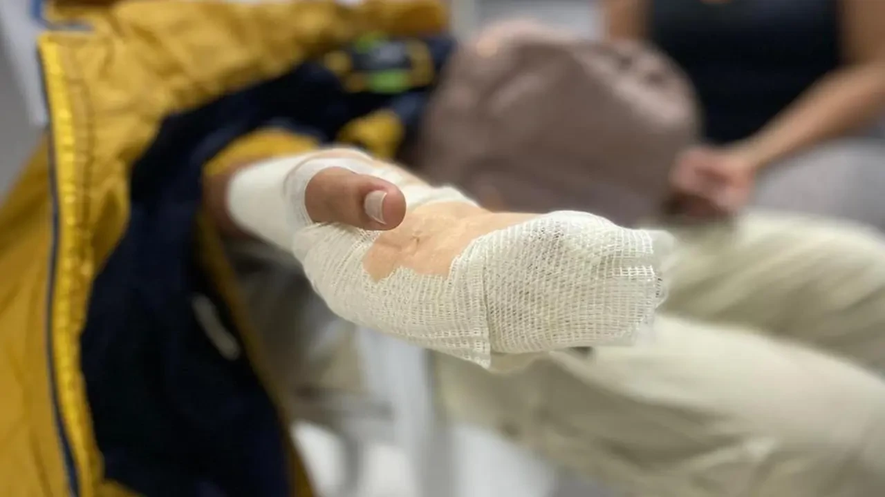 ¿Hasta cuándo? Van 30 quemados por pólvora en Antioquia