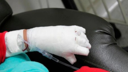 ¡Qué tristeza! Sigue en aumento la cifra de quemados de pólvora en Antioquia ¡Qué tristeza! Sigue en aumento la cifra de quemados de pólvora en Antioquia