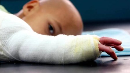 Van 149 quemados por pólvora hasta la fecha en Antioquia Van 149 quemados por pólvora hasta la fecha en Antioquia