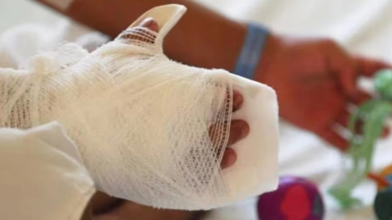 ¡Triste noticia! Aumentaron los quemados por pólvora en Antioquia