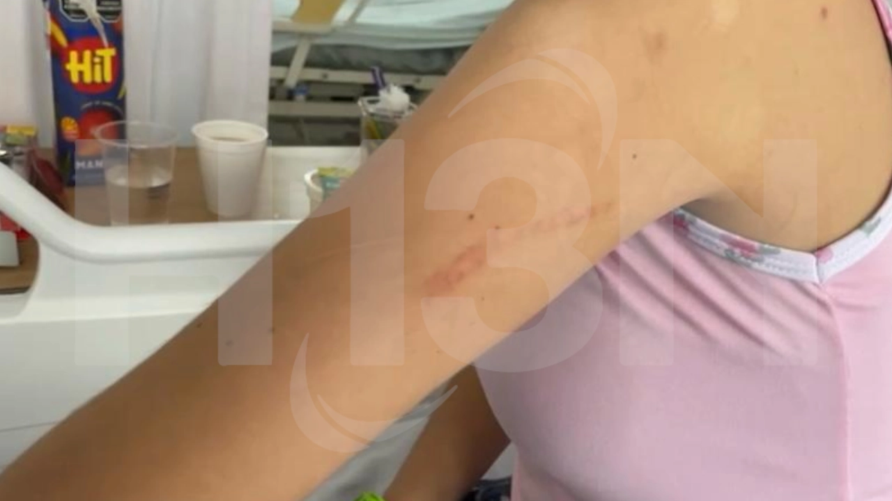 Denuncia: adolescente quedó hospitalizada tras brutal golpiza a manos de su propia madre en Robledo