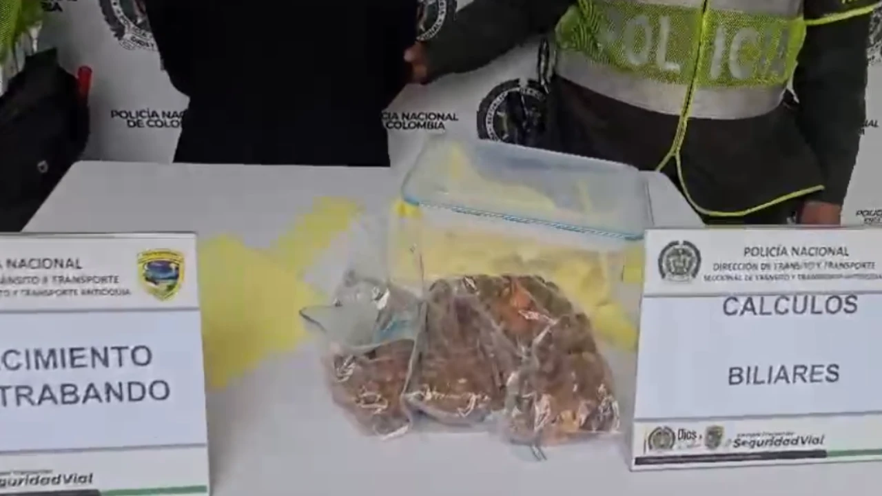 incautacion-calculos-biliares-bovino-medellin-bogota2