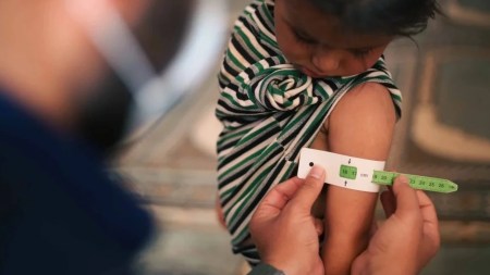 Gobernación de Antioquia hace un llamado de atención para combatir los casos de desnutrición infantil