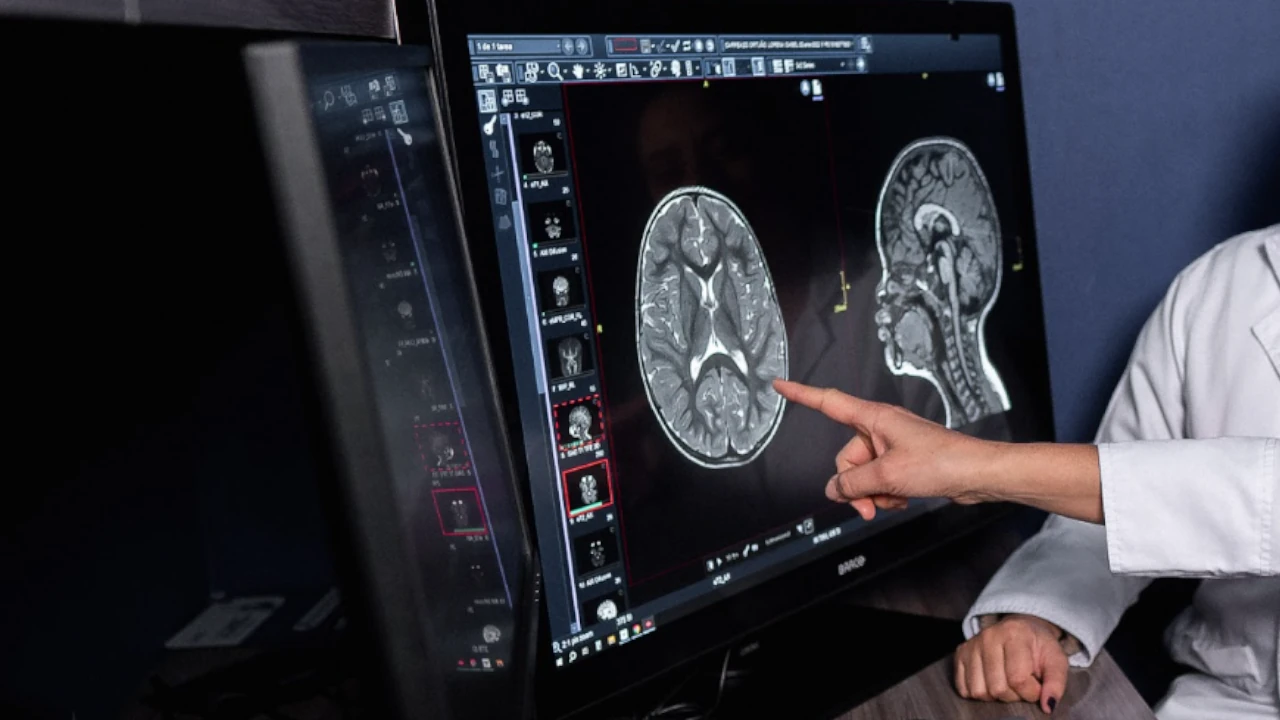 hospital-sanvicente-medellin-pionero-neurocirugia-pediatrica-medica