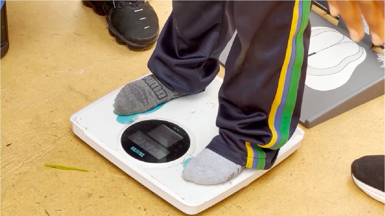 desnutricion-infantil