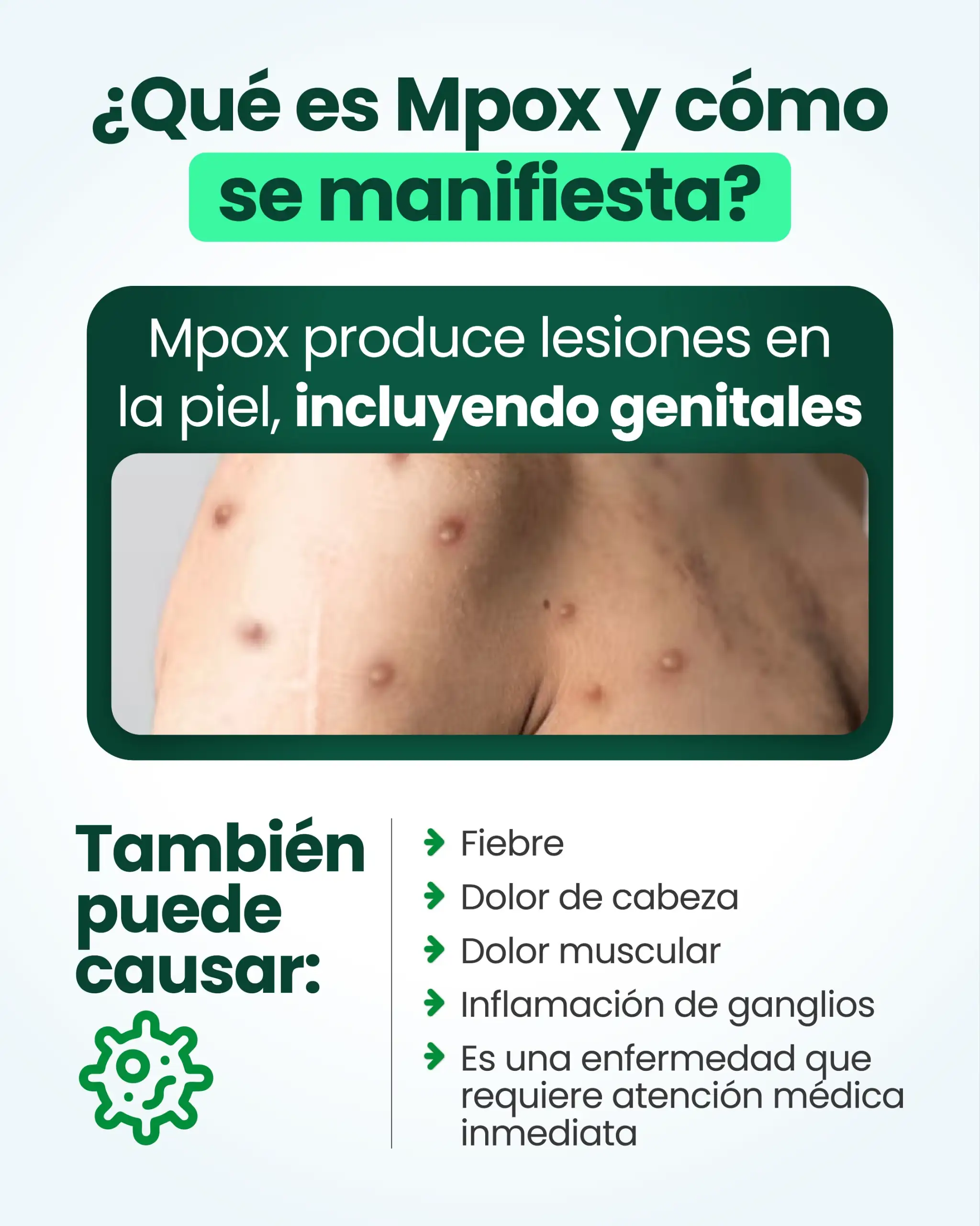 Alerta en Antioquia por aumento de casos de Mpox; hacen llamado al autocuidado 1 Antioquia refuerza medidas de autocuidado ante aumento de casos de Mpox