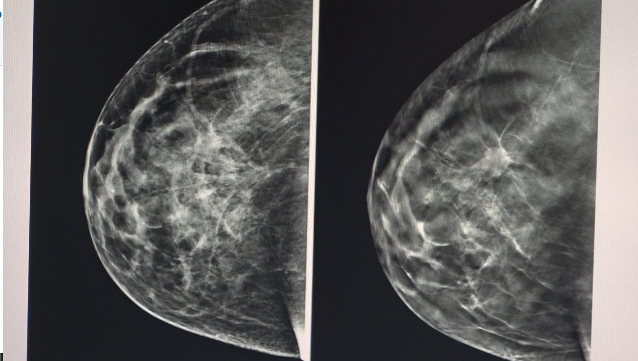 Medellín se une contra el cáncer de mama con el Festival Rosa 2025