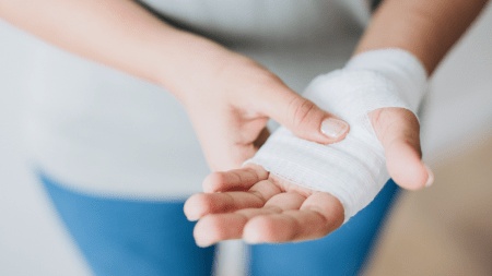 El 90% de las lesiones ocasionadas con pólvora en diciembre, son quemaduras Pólvora - quemados