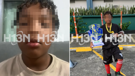 Niño perdió sus dientes tras ser atropellado por motociclista que huyó en Medellín