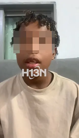 Niño perdió sus dientes tras ser atropellado por motociclista que huyó en Medellín