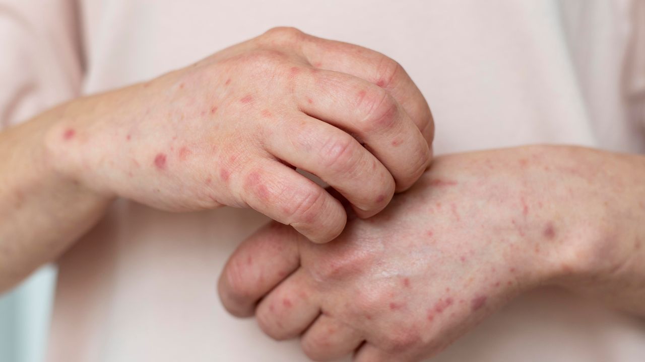 Ahora puede seguirnos en nuestro canal de noticias en WhatsApp. 15